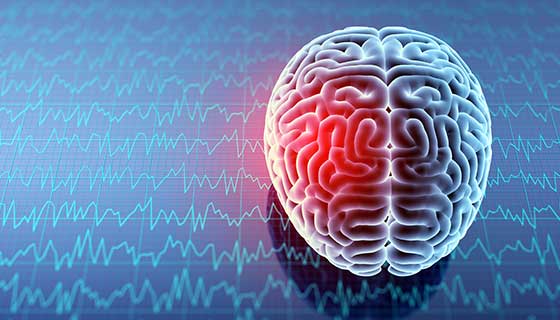 Understand Traumatic Brain Injury and How to File a Claim after an Accident Understand Traumatic Brain Injury and How to File a Claim after an Accident